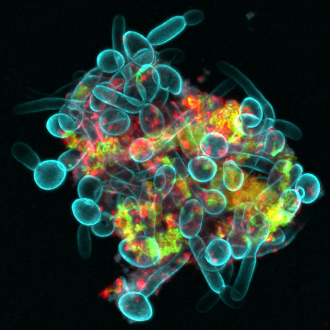 a clump of bacteria and yeast